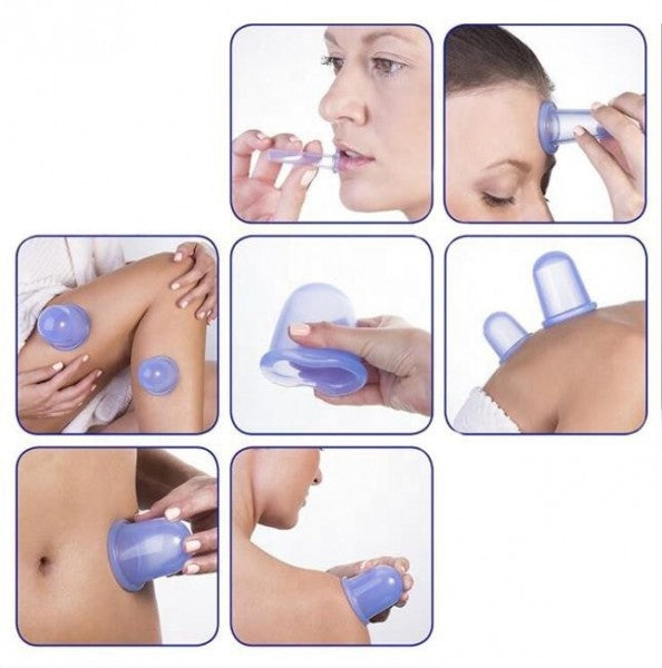 Komplet štirih silikonskih ventuz