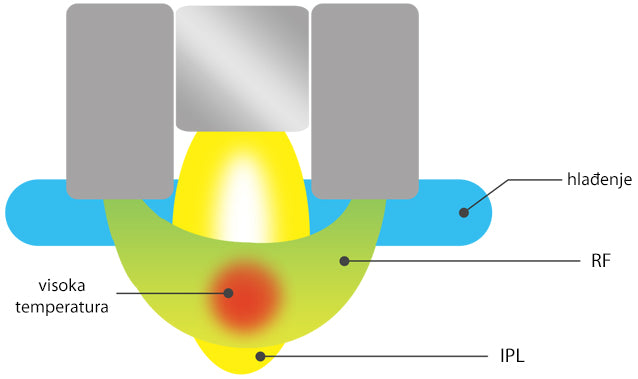eLite Ana SHR IPL+RF