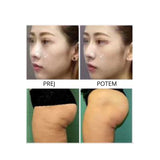 Mini hifu naprava 6v1