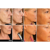 Plasma ART za njego lica