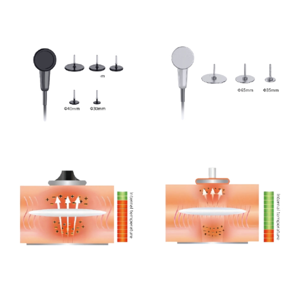 RoboART master AI therapist