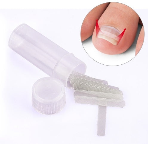 Sponke za vraščene nohte 10/1