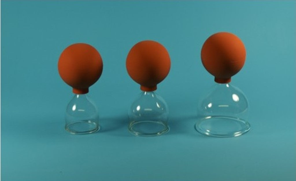 Ventuze steklene 1/3