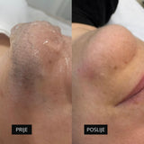 Diodni laser TrisCAM - najam