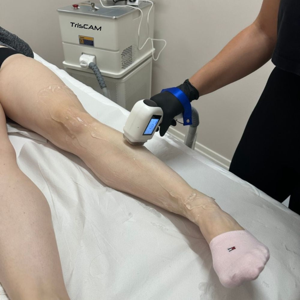 Diodni laser TrisCAM - najam