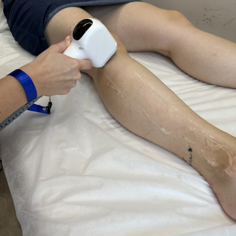 Diodni laser TrisCAM